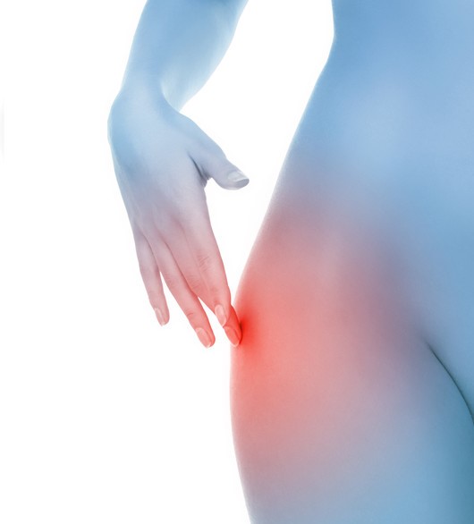 Case Study – Female with Lateral hip Pain